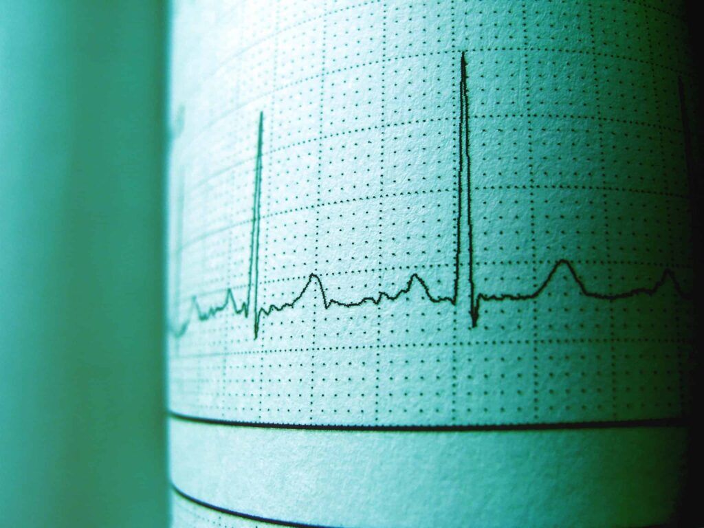 Cardioversion Vs Defibrillation